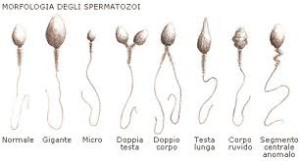 spermiogramma