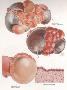 cistoma